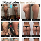 SculptFit – Leggins Anti Celulitis y Lifting